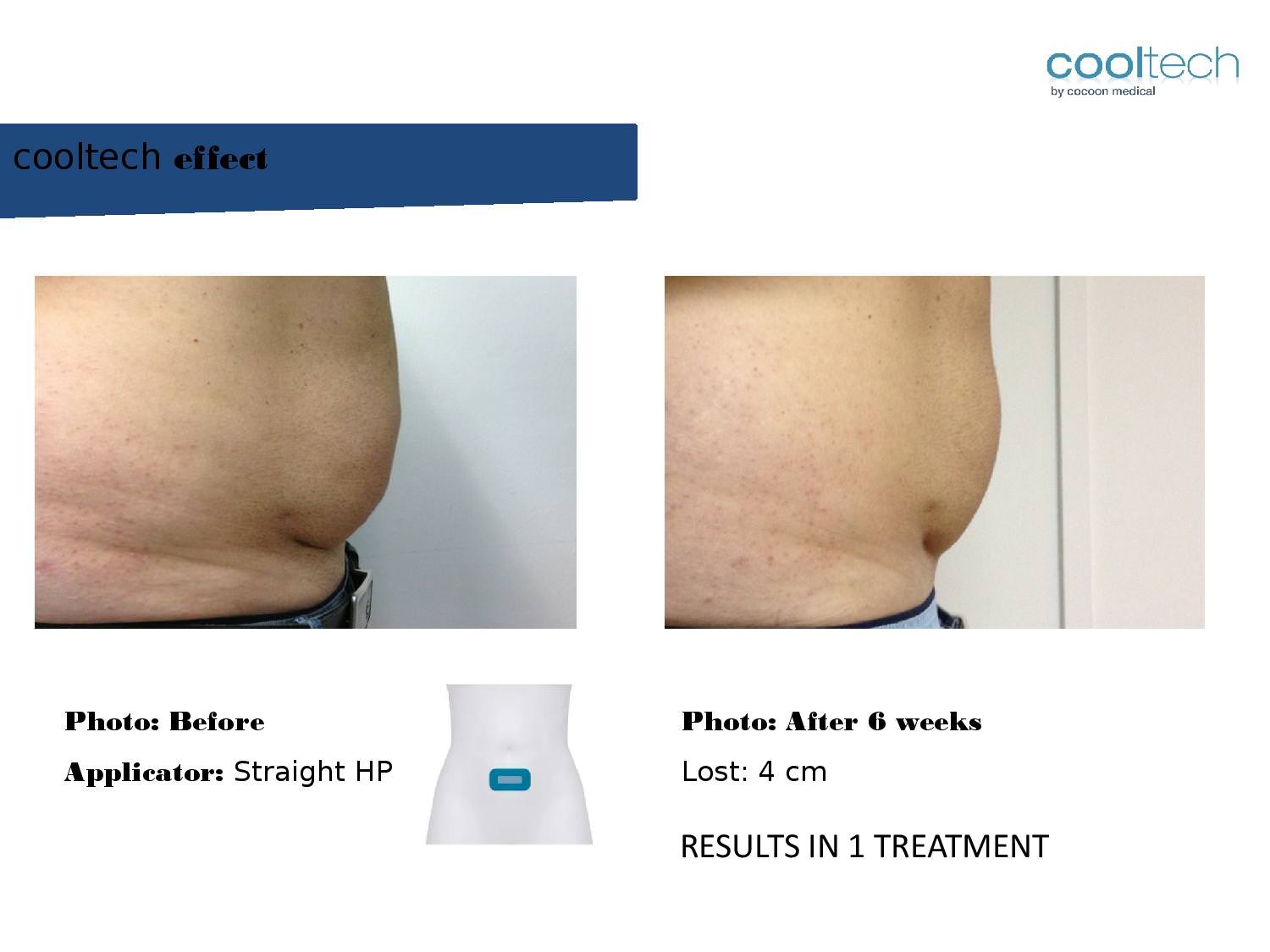 Presentation Cooltech ENG Wigmore Days Novaaaa1-page-012